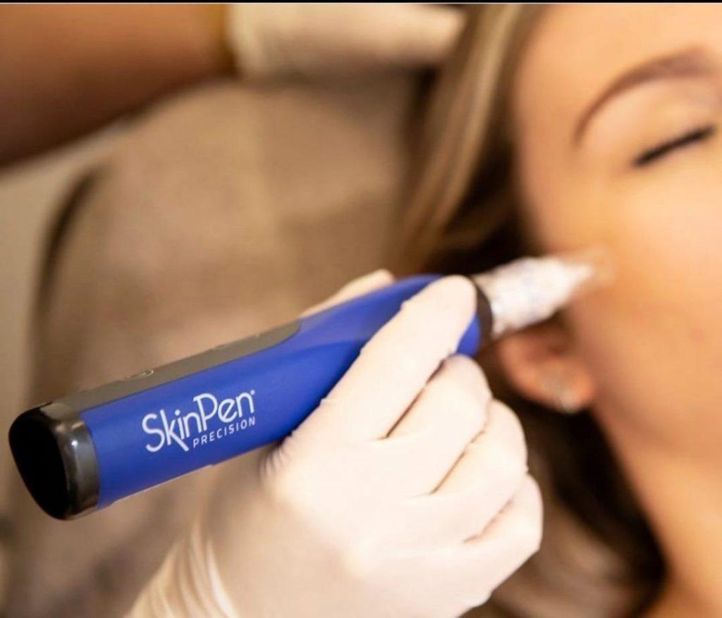 Candela Laser Therapy